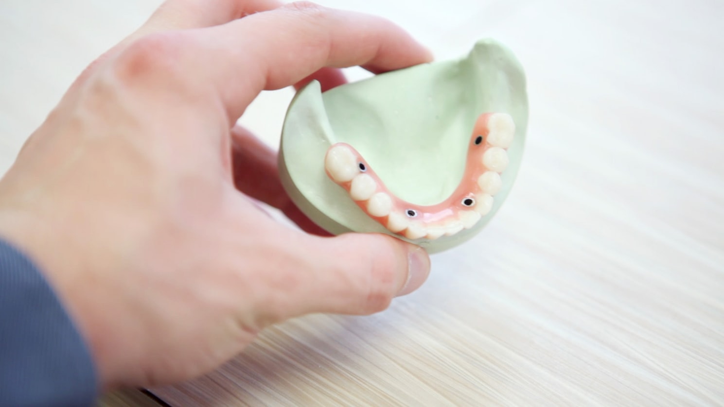 Prothèse dentaire mâchoire complète avec implants dentaires